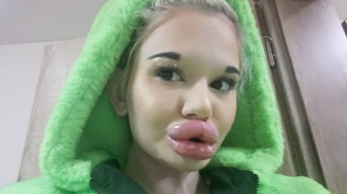 «Андреа