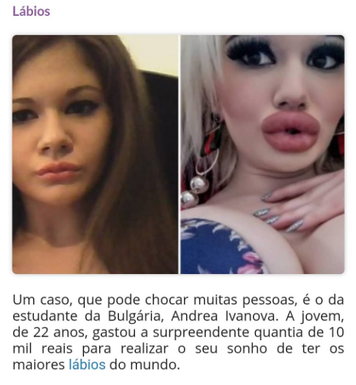 «Андреа