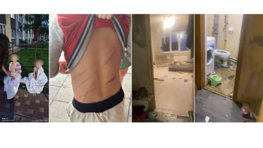 Соцзащита поможет битым и голодным детям