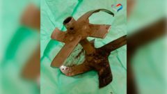 В Череповце врачи спасли ногу 74-летнему дачнику после травмы культиватором